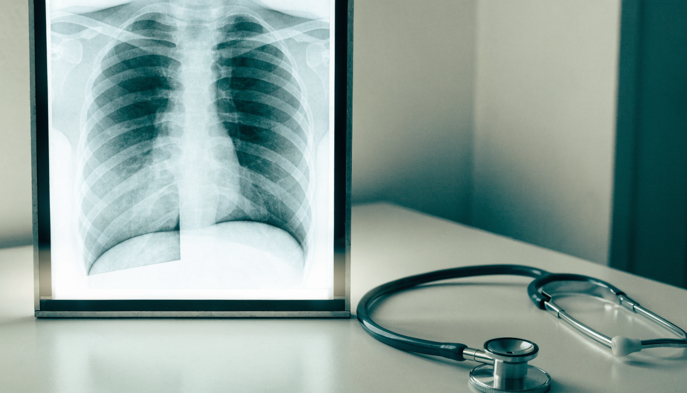 Pneumologia na prova de título: o que estudar
