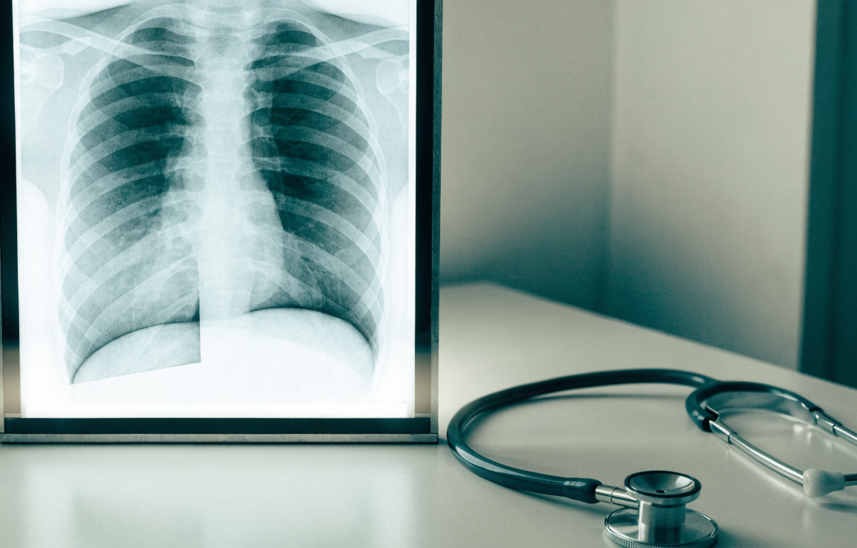 Pneumologia na prova de título: o que estudar